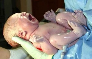 neonato